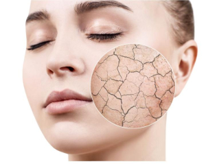 Đầu mùa lạnh: Da khô, bong tróc tăng mạnh – Nguyên nhân chuyên sâu và Giải pháp khoa học