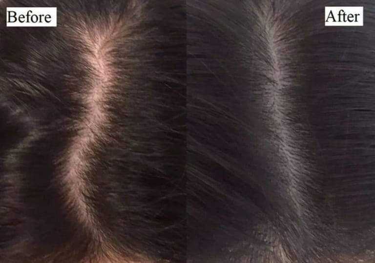 Lợi Ích Nổi Bật Của Tinh Dầu Bưởi Cho Mái Tóc